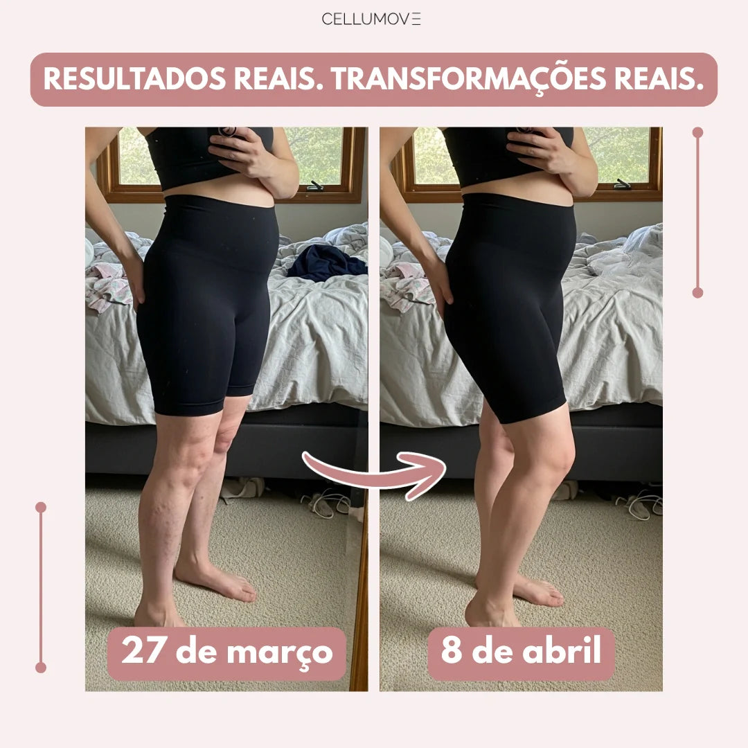 Legging Cellumove 3D – Soulagez et prévenez naturellement les varices.