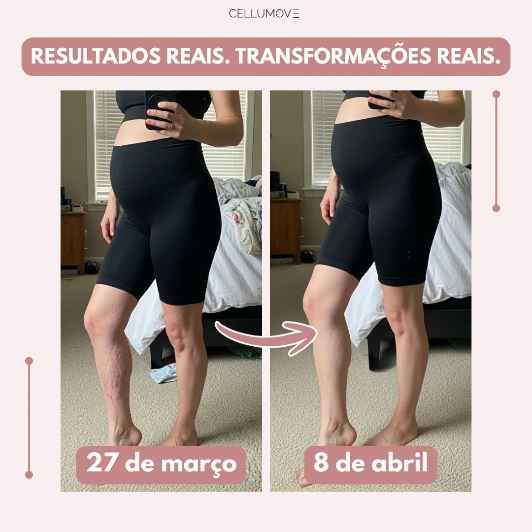 Legging Cellumove 3D – Soulagez et prévenez naturellement les varices.