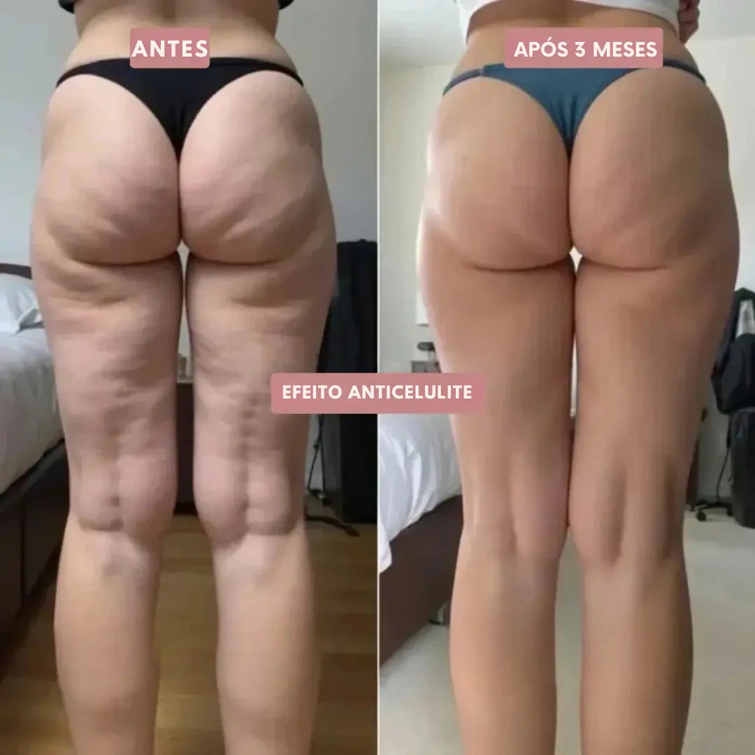 Legging Cellumove 3D – Redefina a sua silhueta sem esforço