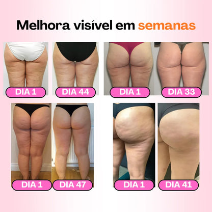 Meias-calças anticelulíticas - Redefina a sua silhueta sem esforço (Embalagem de 3)
