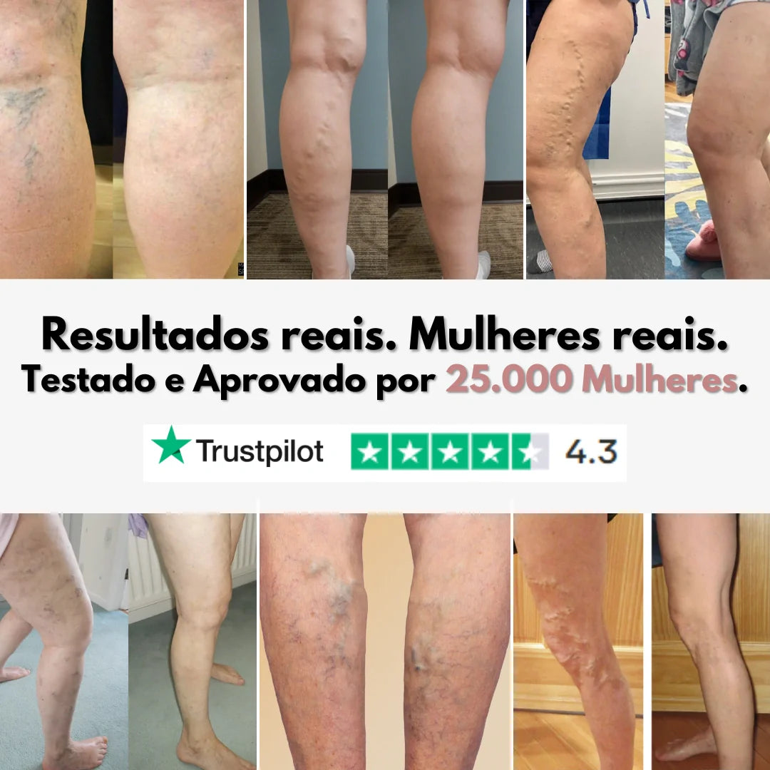 Legging Cellumove 3D – Soulagez et prévenez naturellement les varices.