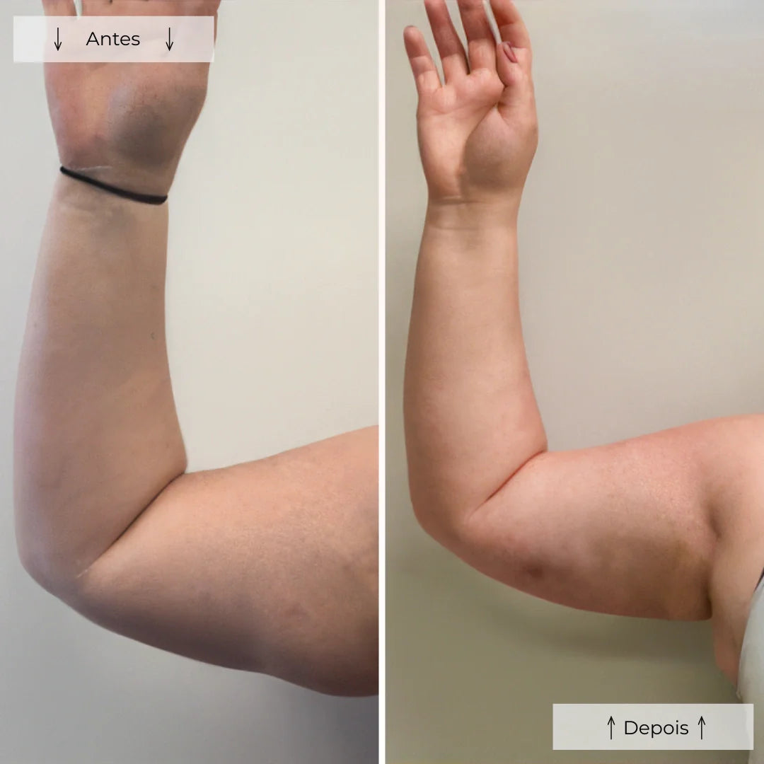 Cellumove Red Light Therapy - Éliminez la cellulite en 28 jours