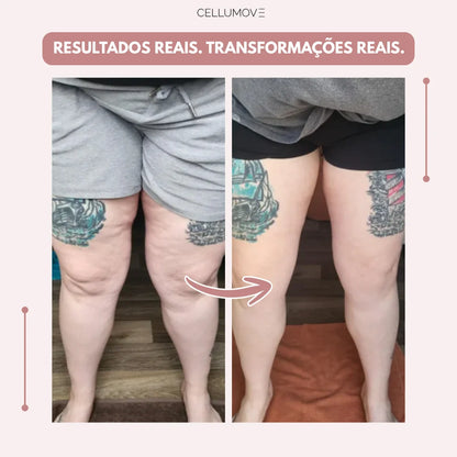 Legging Cellumove 3D – Diga adeus à dor e ao inchaço do lipedema de forma natural
